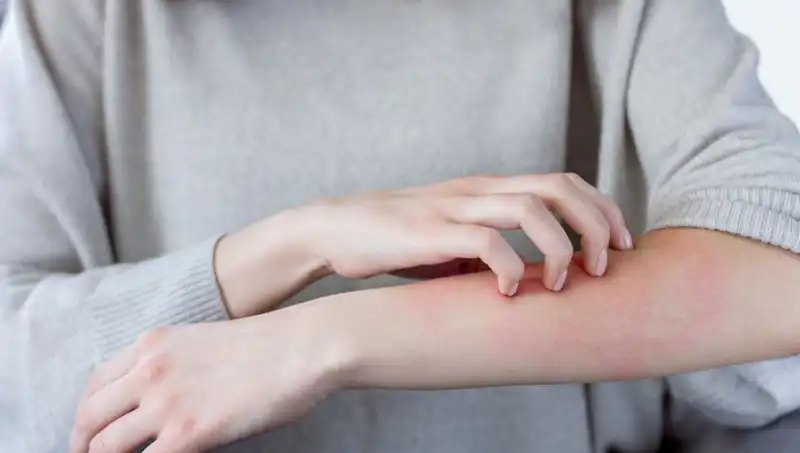 Cilt Kanserinin Gözden Kaçan 2 Belirtisi: Dermatologdan Uyarılar
