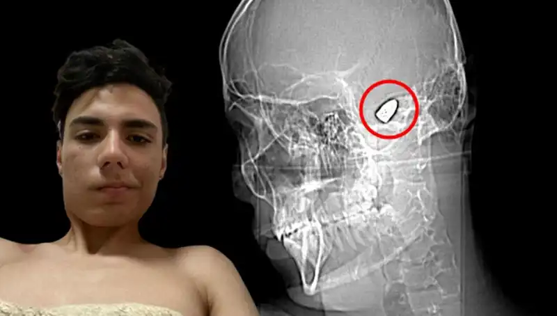 Kafasında Patlamaya Hazır Bomba: Hayatının En Zor Anlarında Yaşadığı Çarpıcı Hikaye